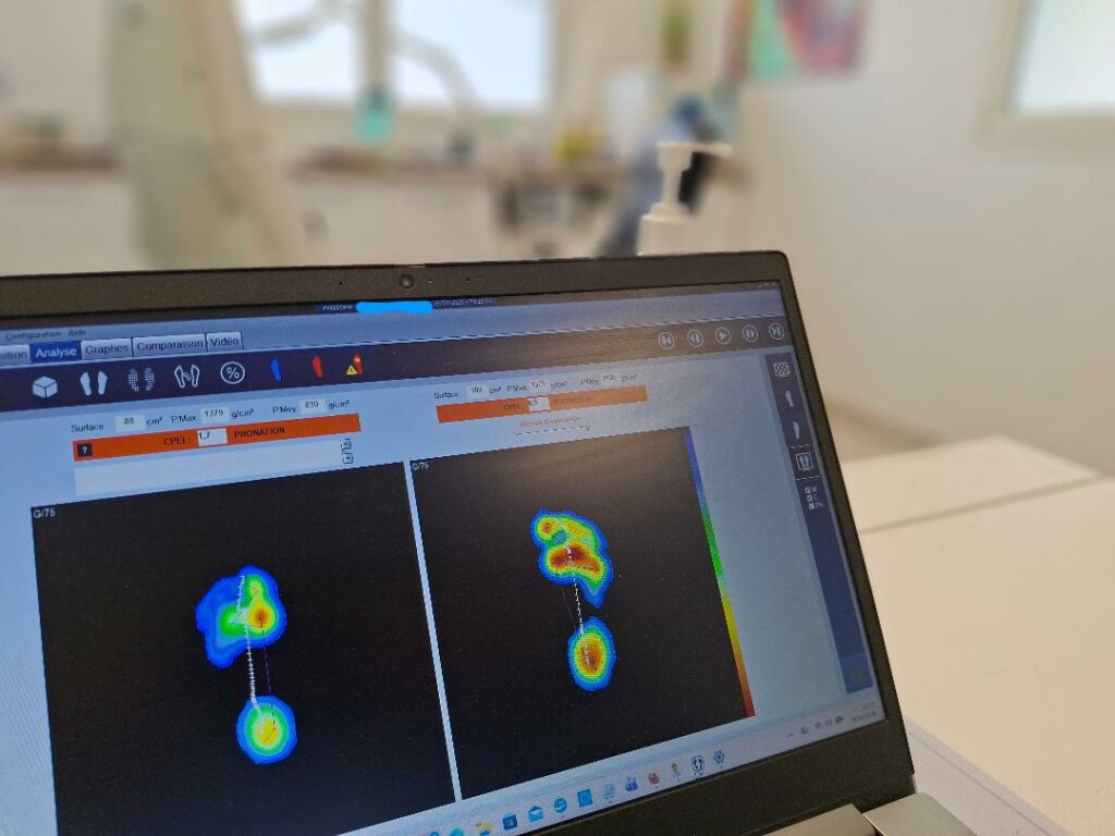 Analyse de la stabilité du pied avec plateforme à capteurs de pression